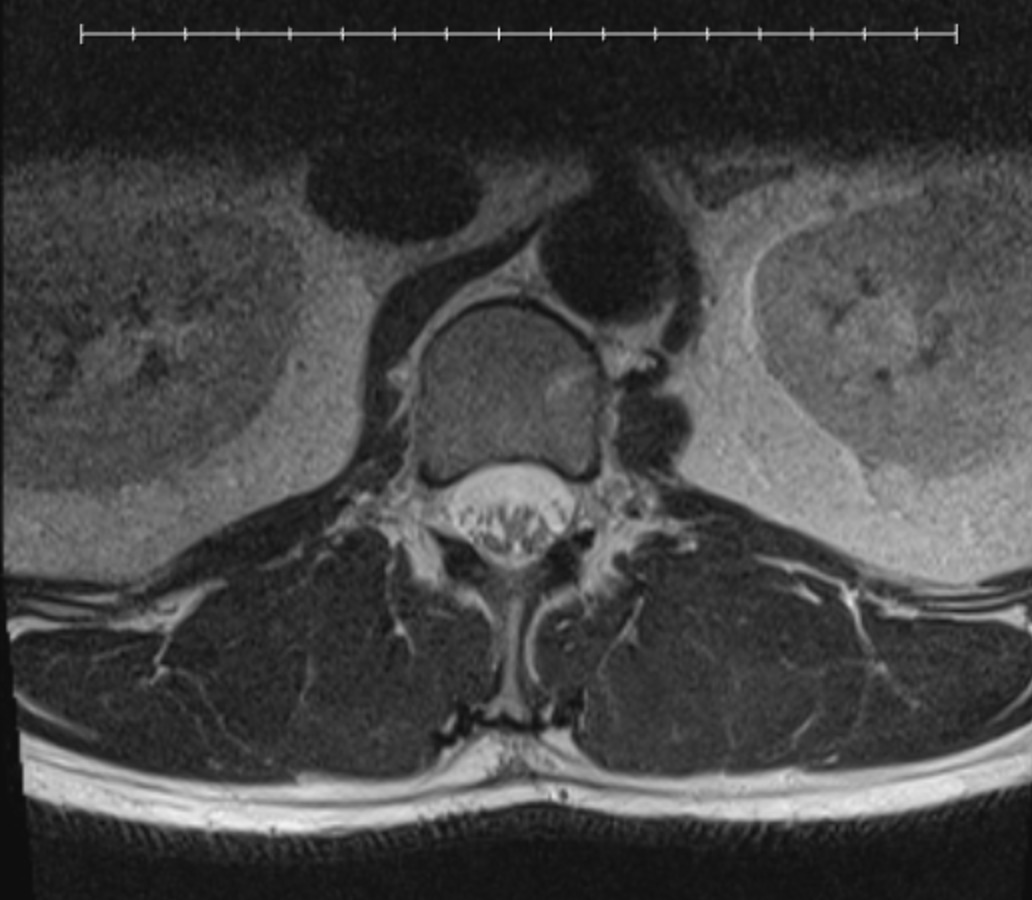 Digital CT scan imaging that has to be sent by physical disc to the spine clinic.