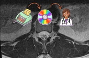 Healthcare in 2026: Still Faxing, Already Talking About AI Cross-sectional CT scan image of spine showing disc degeneration, shared via patient portal because physical CD had not yet arrived