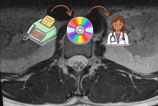 Healthcare in 2026: Still Faxing, Already Talking About AI Cross-sectional CT scan image of spine showing disc degeneration, shared via patient portal because physical CD had not yet arrived