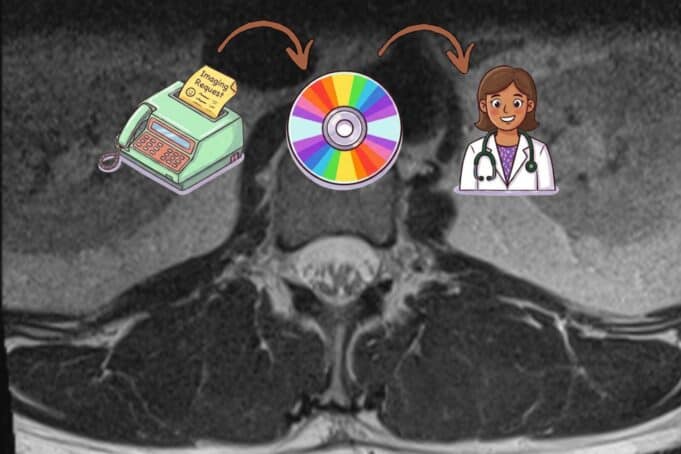 Healthcare in 2026: Still Faxing, Already Talking About AI Cross-sectional CT scan image of spine showing disc degeneration, shared via patient portal because physical CD had not yet arrived